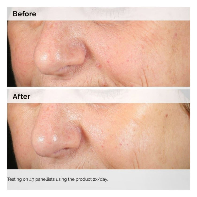 The Ordinary Alpha Arbutin 2% & Hyaluronic Acid Water Based Face Serum For Uneven Skin Tone 30ml