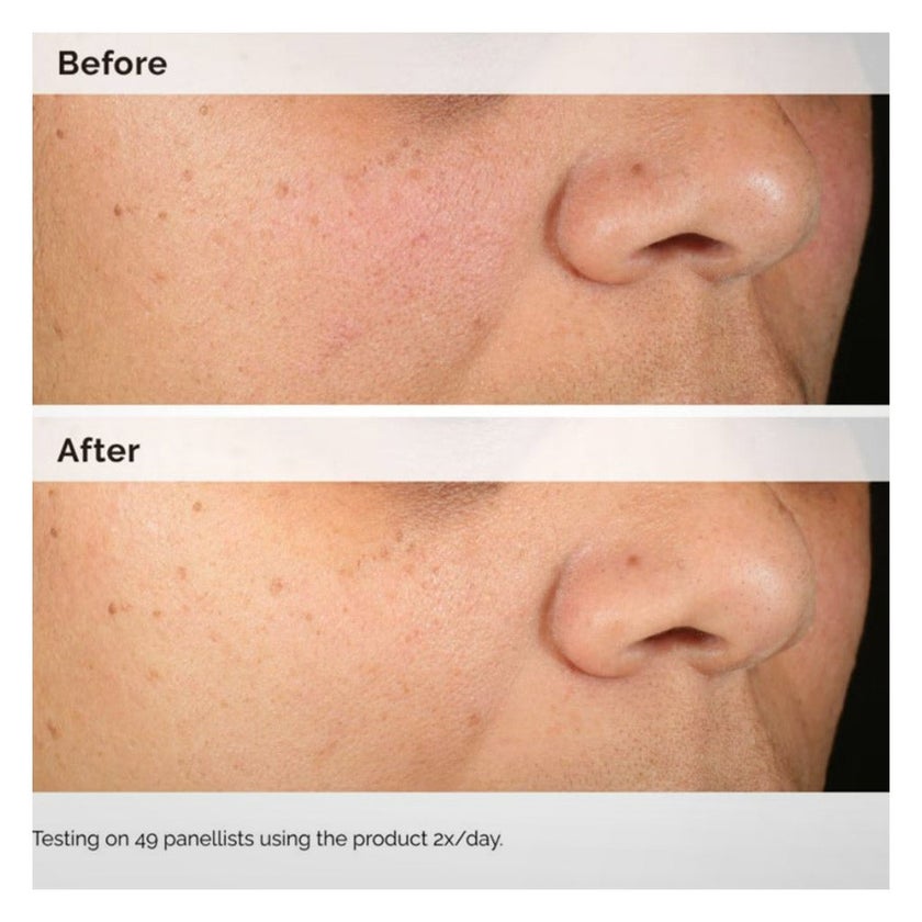 The Ordinary Alpha Arbutin 2% & Hyaluronic Acid Water Based Face Serum For Uneven Skin Tone 30ml