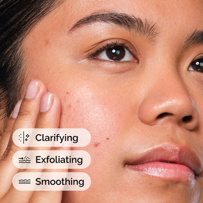 The Ordinary Salicylic Acid 2% Face Serum For Acne Prone Skin 30ml