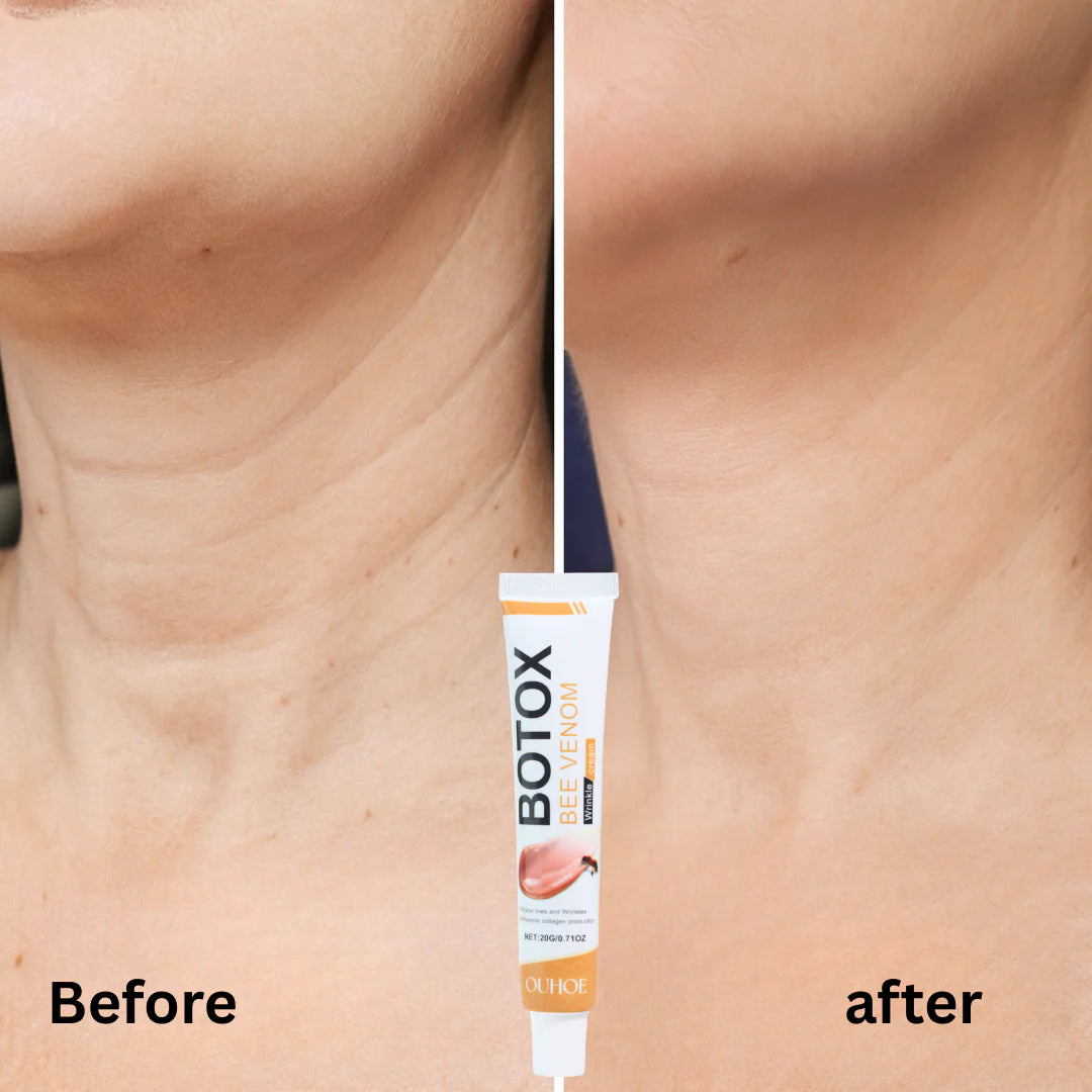 Botox Bee Venom Wrinkle Removal & Firming, Moisturizing, Lifting, Anti-Aging & Recovery for All Skin Type.
