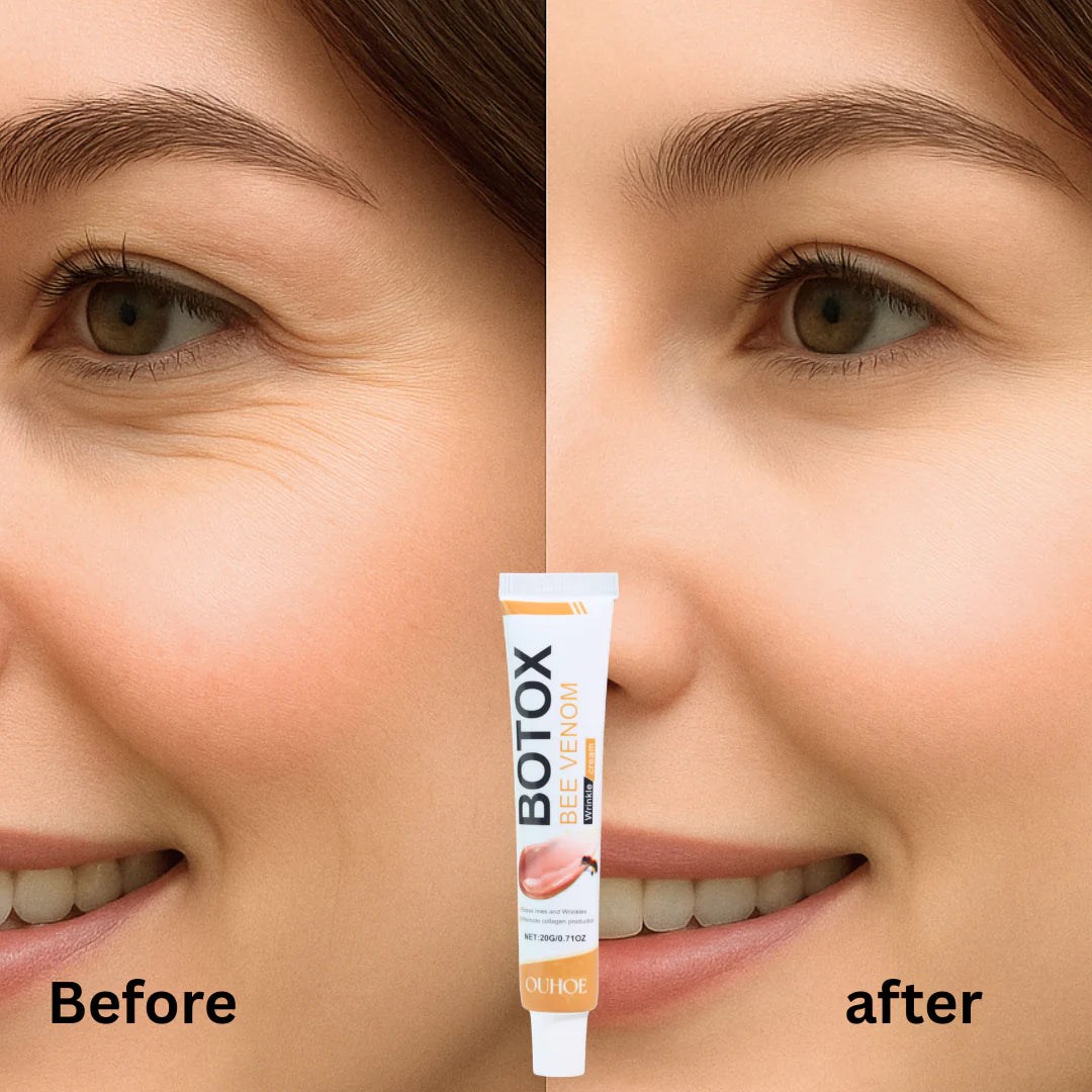 Botox Bee Venom Wrinkle Removal & Firming, Moisturizing, Lifting, Anti-Aging & Recovery for All Skin Type.